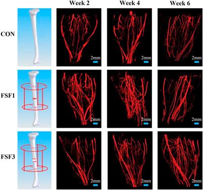 Effect of Inter-Fragmentary Gap Size on Neovascularization During Bone Healing: A Micro-CT Imaging Study